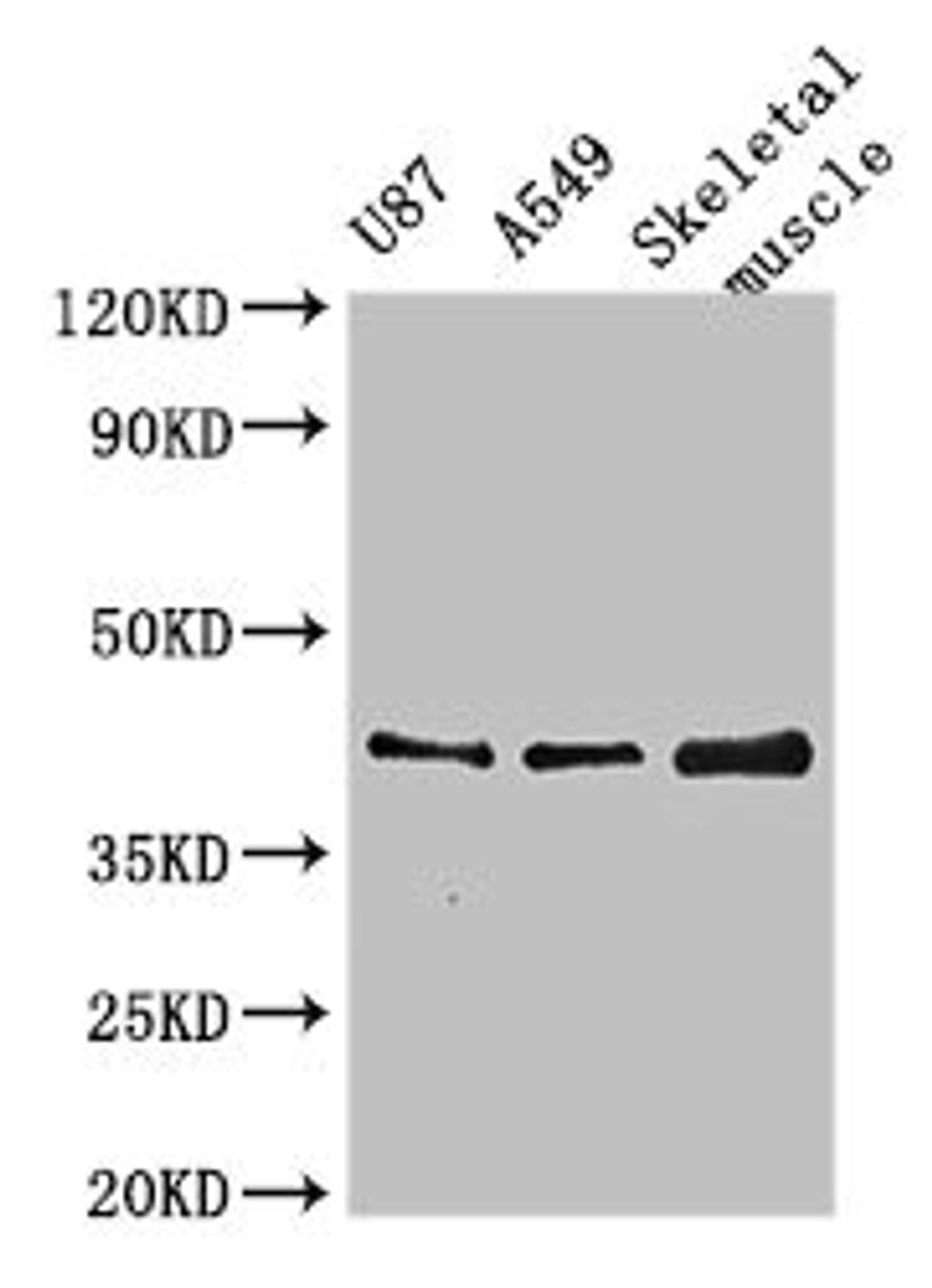 Western Blot. Positive WB detected in: U87 whole cell lysate, A549 whole cell lysate, Mouse skeletal muscle tissue. All lanes: B3GALT4 antibody at 3µg/ml. Secondary. Goat polyclonal to rabbit IgG at 1/50000 dilution. Predicted band size: 42 kDa. Observed band size: 42 kDa