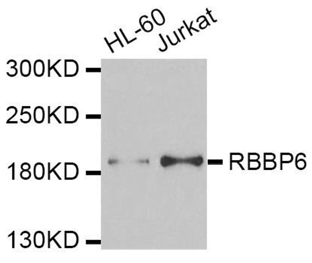 Western blot analysis of extracts of various cell lines using RBBP6 antibody