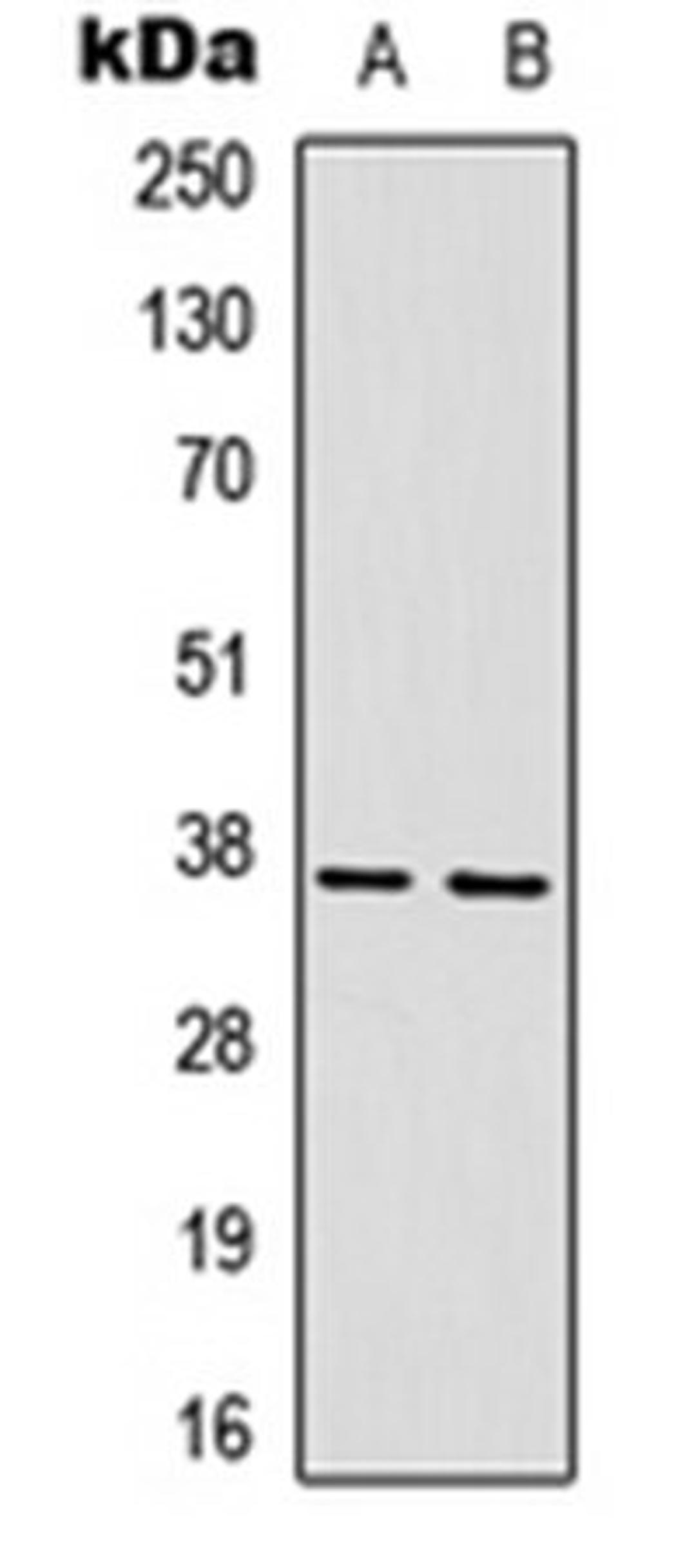 Western blot analysis of HepG2 (Lane 1), mouse brain (Lane 2) whole cell lysates using CD296 antibody