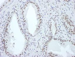 Detection of human ASH2 by immunohistochemistry.