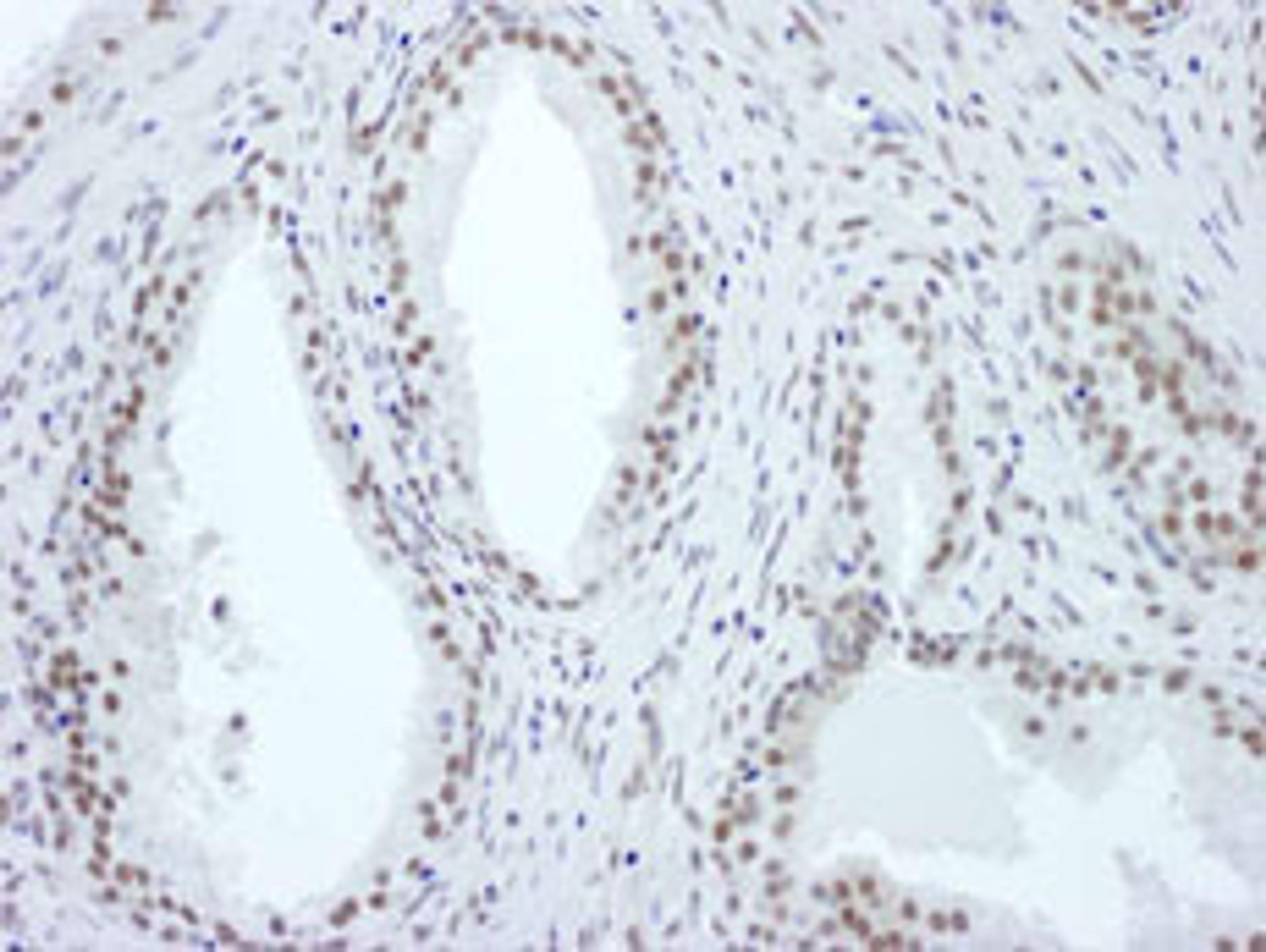 Detection of human ASH2 by immunohistochemistry.