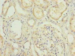 Immunohistochemistry of paraffin-embedded human kidney tissue using CSB-PA02269A0Rb at dilution of 1:100