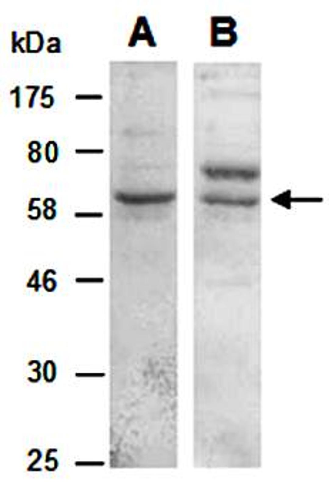 Western blot analysis of total cell extracts from human Jurkat using KLRG1 antibody