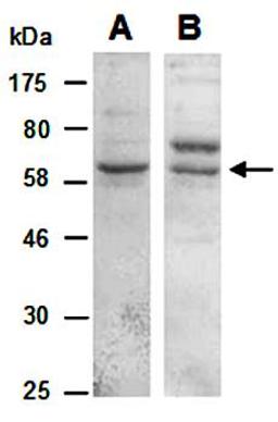 Western blot analysis of total cell extracts from human Jurkat using KLRG1 antibody