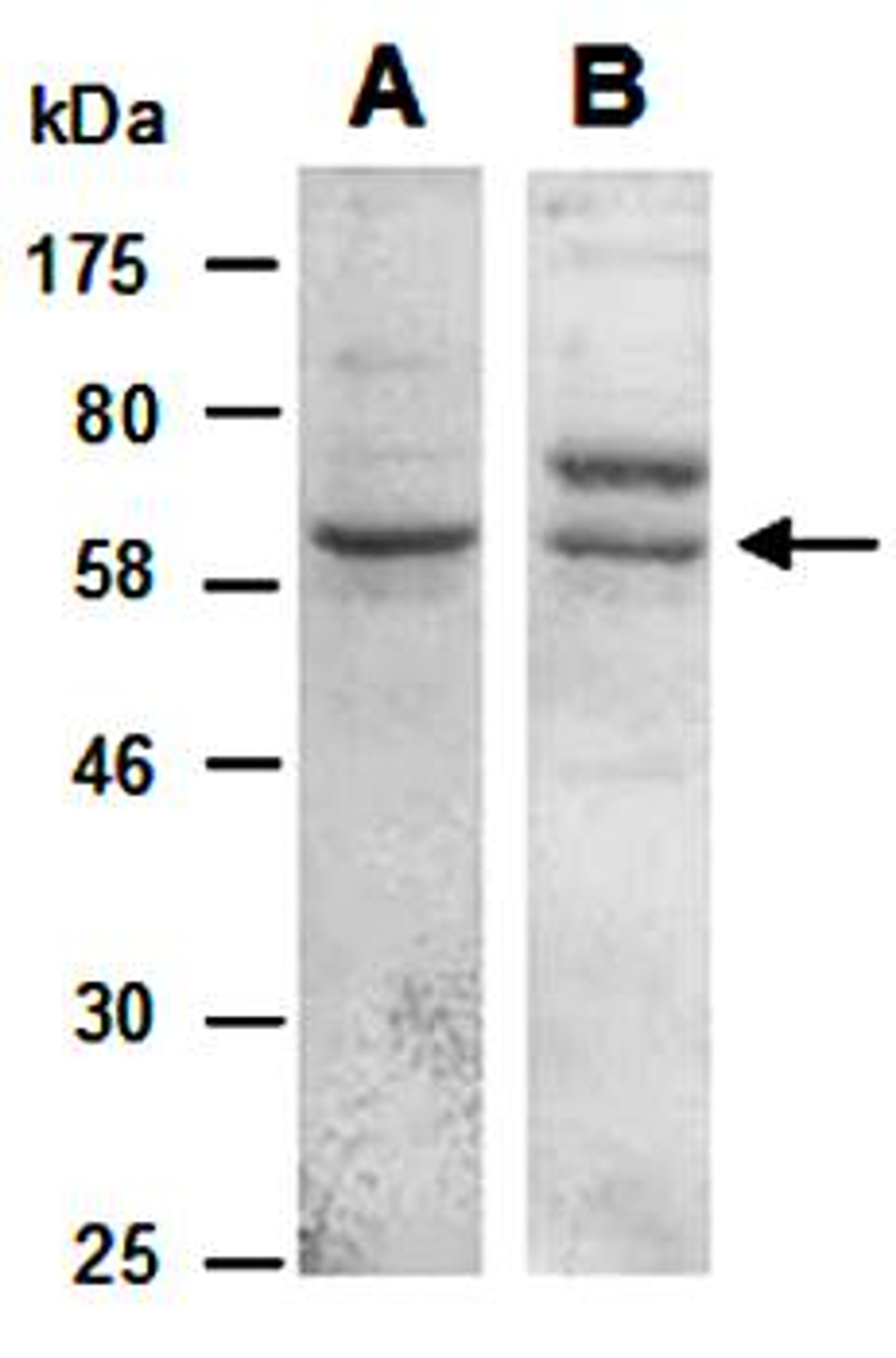 Western blot analysis of total cell extracts from human Jurkat using KLRG1 antibody