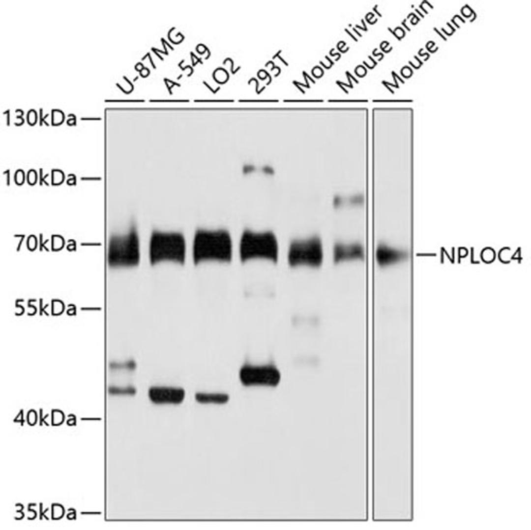 Western blot - NPLOC4 antibody (A3256)