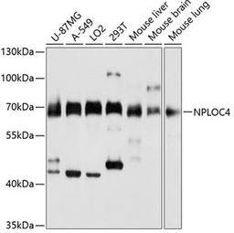 Western blot - NPLOC4 antibody (A3256)