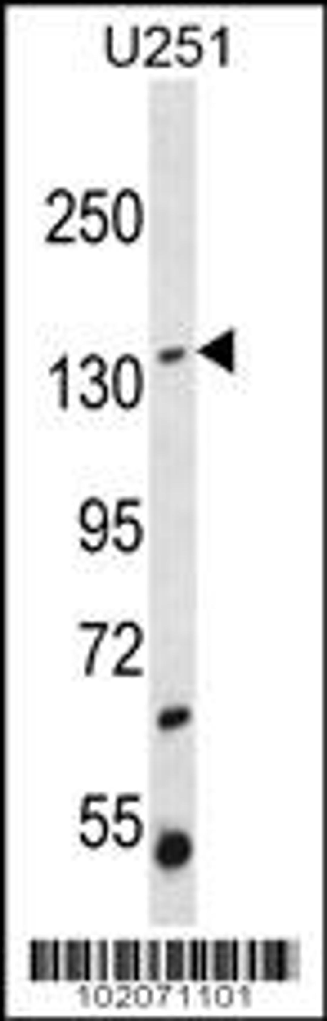 Western blot analysis in U251 cell line lysates (35ug/lane).This demonstrates the ST5 antibody detected the ST5 protein (arrow).