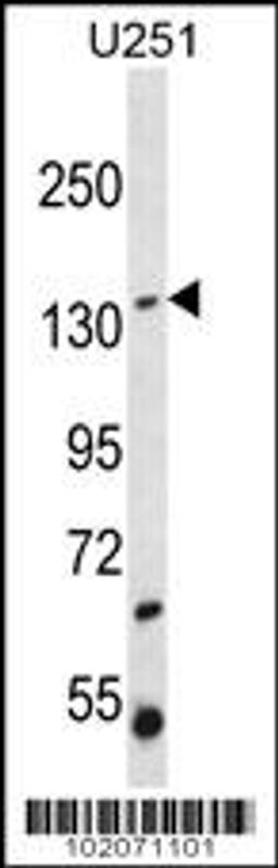 Western blot analysis in U251 cell line lysates (35ug/lane).This demonstrates the ST5 antibody detected the ST5 protein (arrow).