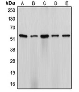 Western blot analysis of HeLa (Lane 1), NIH3T3 (Lane 2), H9C2 (Lane 3), SW13 (Lane 4), ES2 (Lane 5) whole cell lysates using CYP17A1 antibody