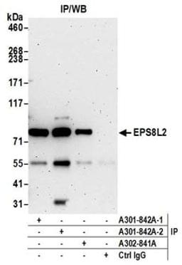 Detection of human EPS8L2 by western blot of immunoprecipitates.