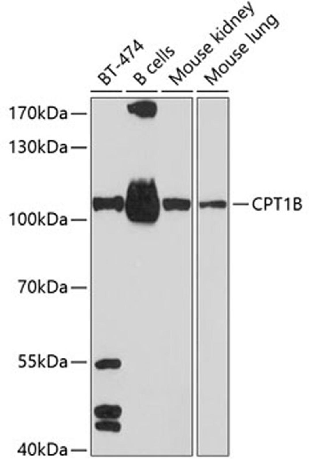 Western blot - CPT1B antibody (A6796)