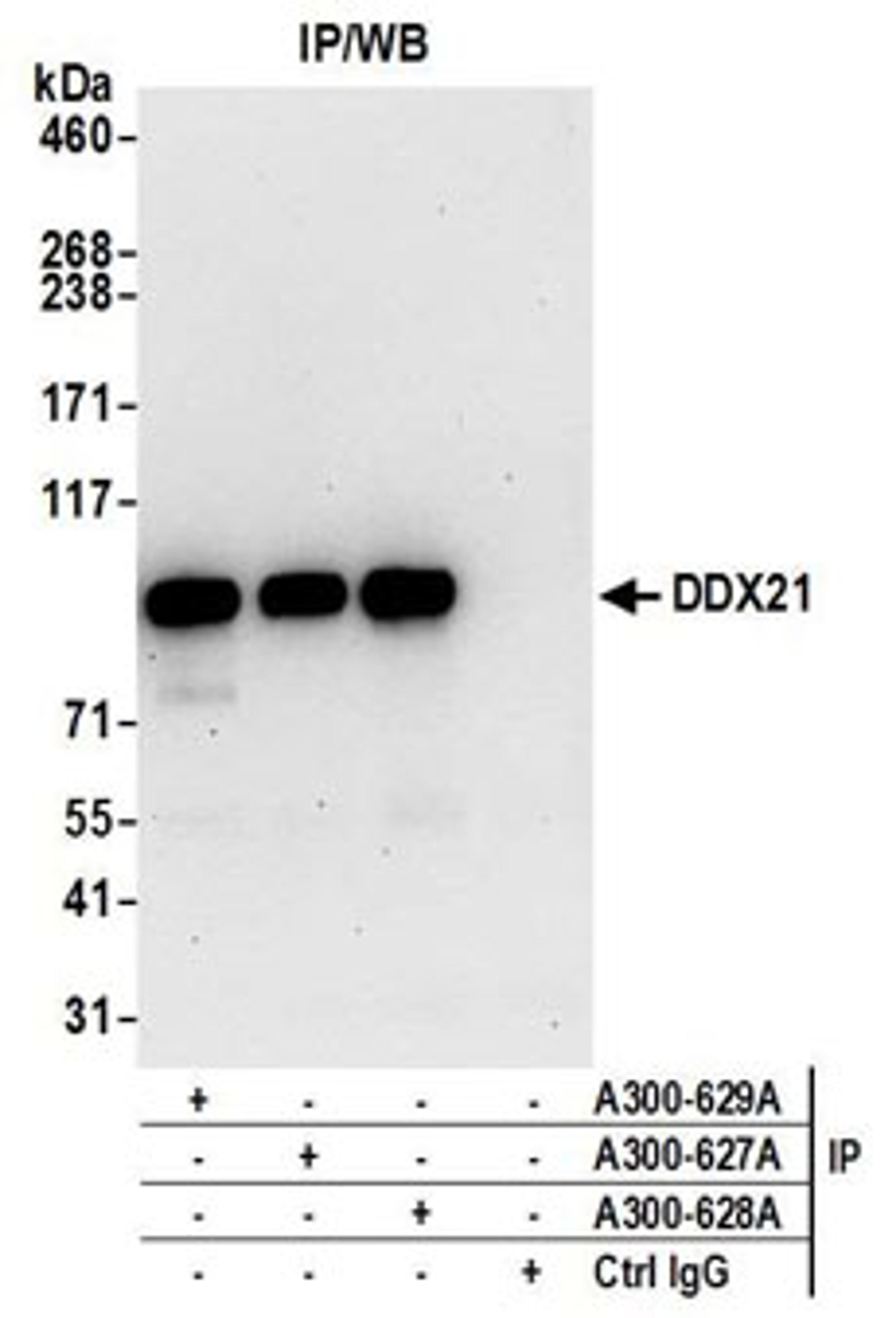 Detection of human DDX21 by western blot of immunoprecipitates.