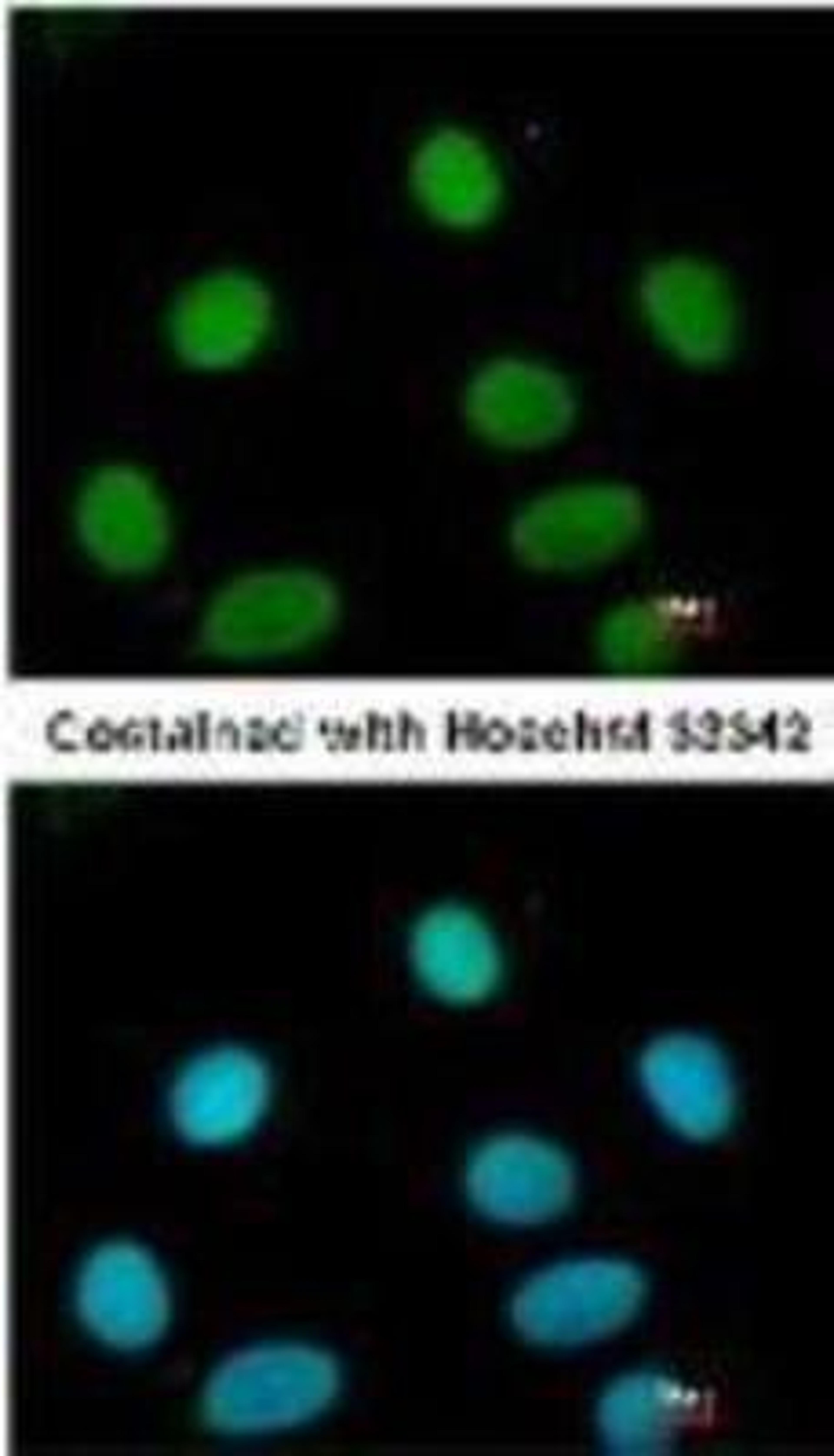 Immunocytochemistry/Immunofluorescence: FEN-1 Antibody (4E7) [NB100-150] - Analysis of paraformaldehyde-fixed MCF7, using antibody at 1:200 dilution.