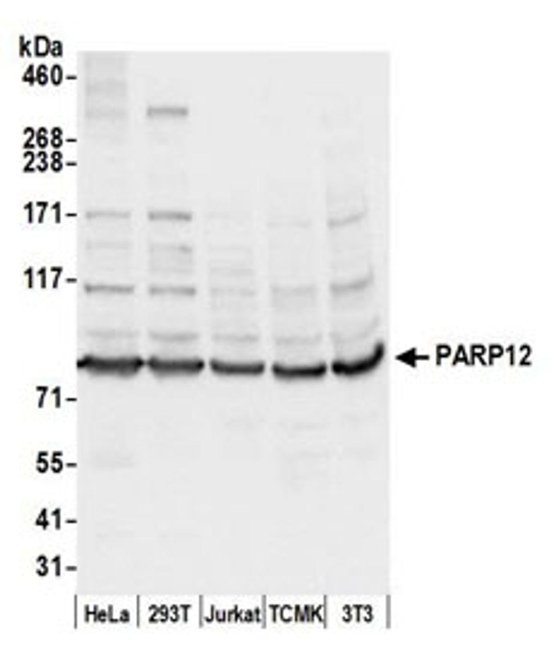 Detection of human and mouse PARP12 by western blot.