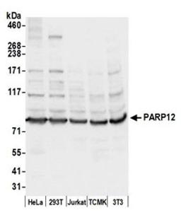 Detection of human and mouse PARP12 by western blot.