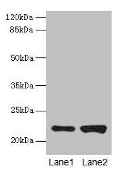 Western blot. All lanes: CDC42 antibody at 6µg/ml. Lane 1: Hela whole cell lysate. Lane 2: Jurkat whole cell lysate. Secondary. Goat polyclonal to rabbit IgG at 1/10000 dilution. Predicted band size: 22 kDa. Observed band size: 22 kDa