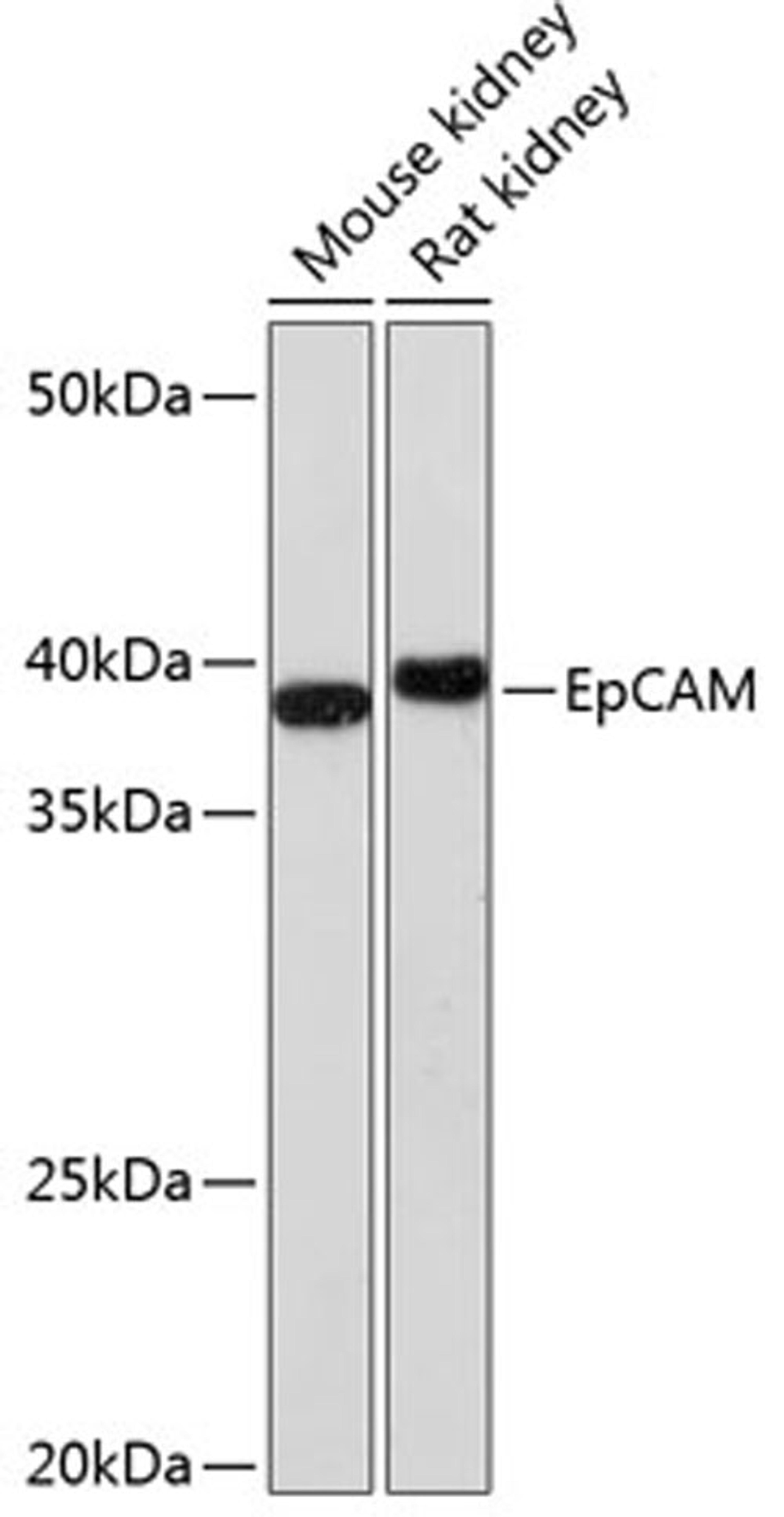 Western blot - EpCAM Rabbit mAb (A1107)