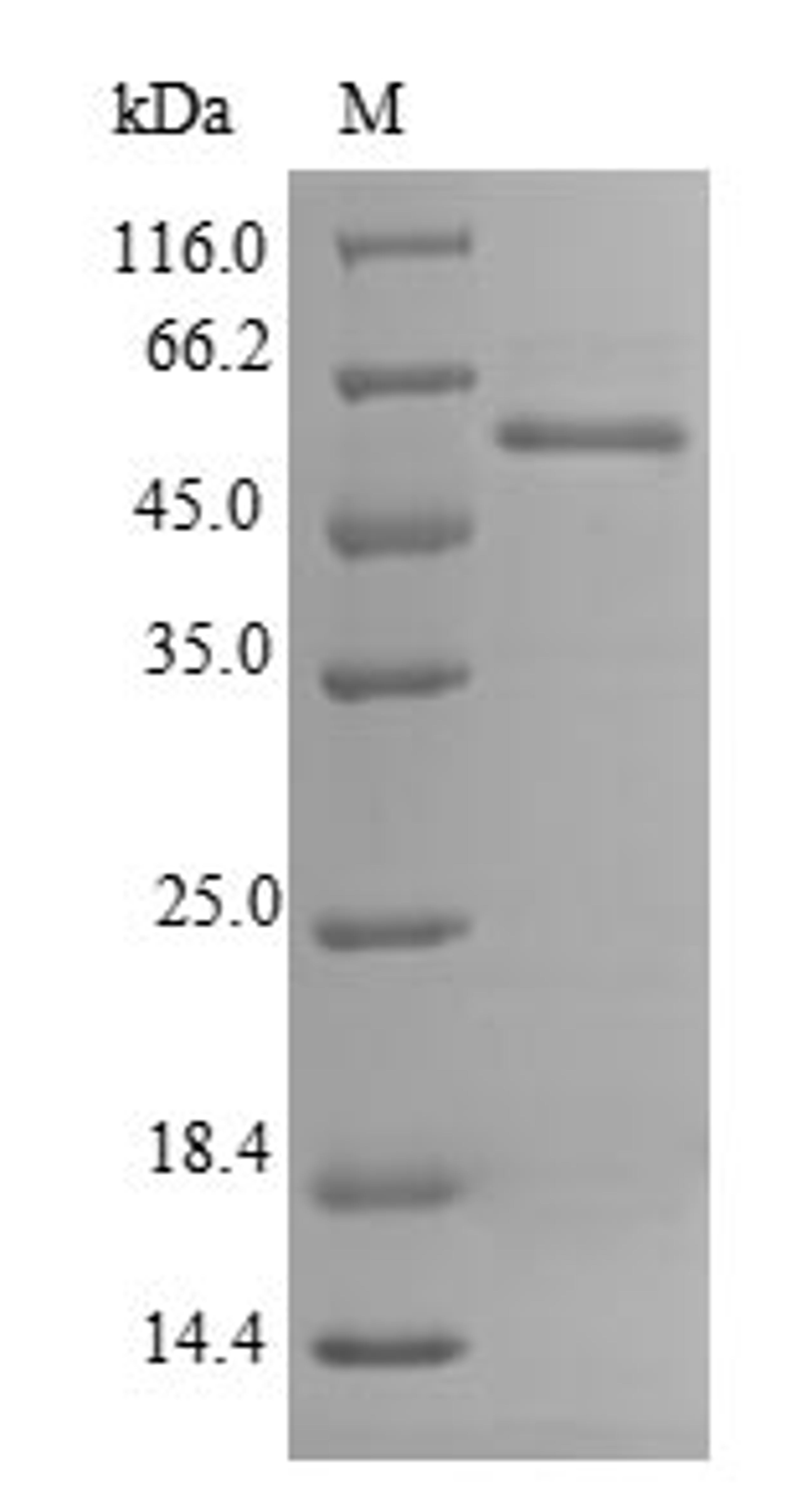 (Tris-Glycine gel) Discontinuous SDS-PAGE (reduced) with 5% enrichment gel and 15% separation gel.