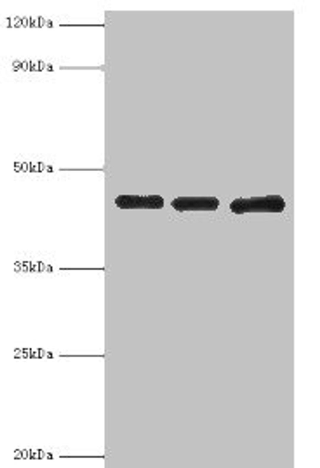 Western blot. All lanes: Poliovirus receptor antibody at 3ug/ml. Lane 1: Mouse gonad tissue. Lane 2: HepG2 whole cell lysate. Lane 3: K562 whole cell lysate. Secondary. Goat polyclonal to rabbit IgG at 1/10000 dilution. Predicted band size: 46, 41, 40, 43 kDa. Observed band size: 46 kDa. 