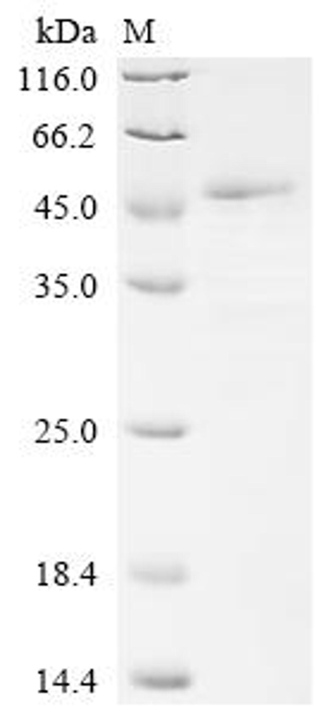 (Tris-Glycine gel) Discontinuous SDS-PAGE (reduced) with 5% enrichment gel and 15% separation gel.