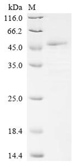 (Tris-Glycine gel) Discontinuous SDS-PAGE (reduced) with 5% enrichment gel and 15% separation gel.