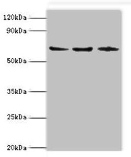 Western blot. All lanes: ACAD9 antibody at 6ug/ml. Lane 1: MCF-7 whole cell lysate. Lane 2: 293T whole cell lysate. Lane 3: K562 whole cell lysate. Secondary. Goat polyclonal to rabbit IgG at 1/10000 dilution. Predicted band size: 69 kDa. Observed band size: 69 kDa.