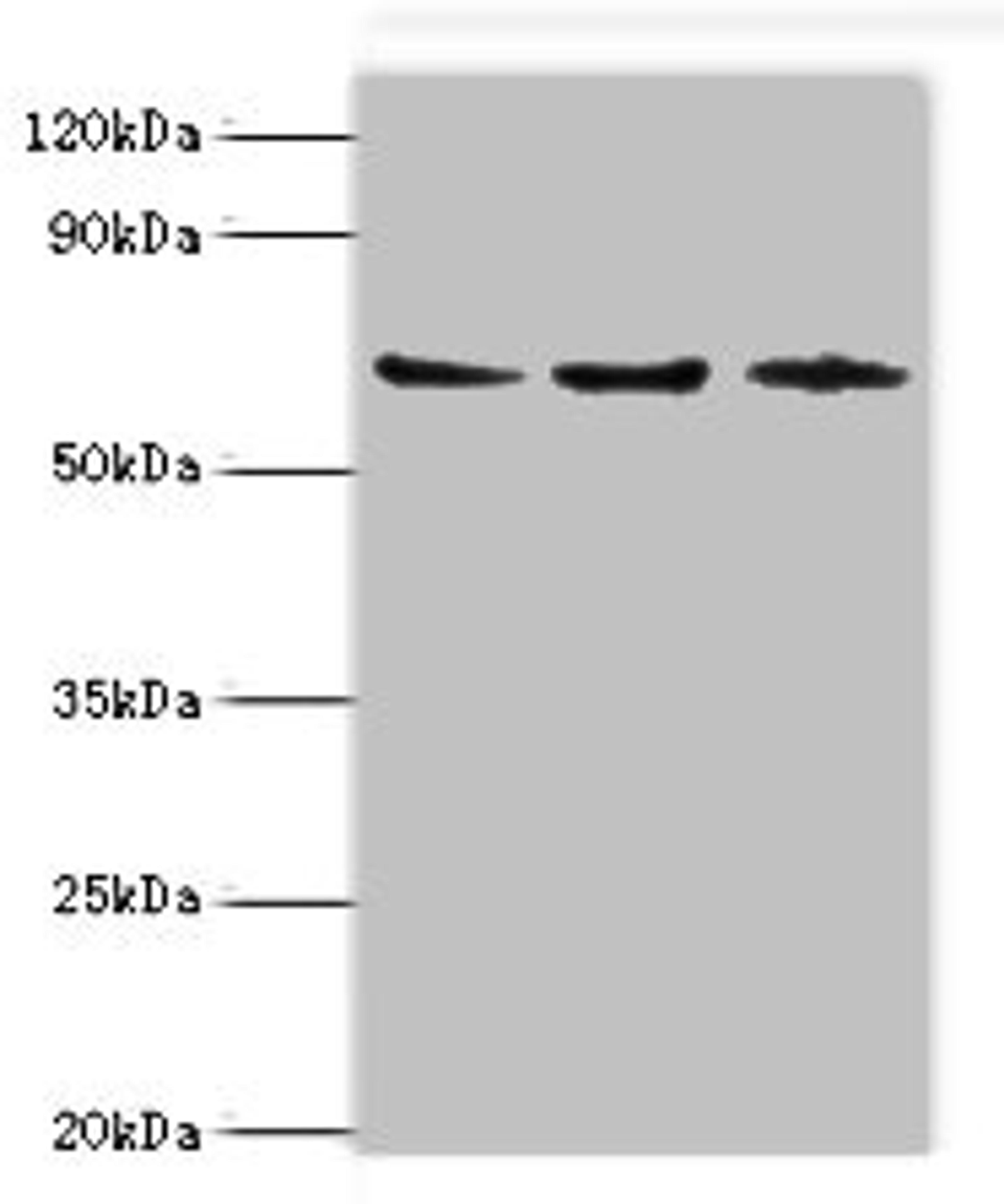 Western blot. All lanes: ACAD9 antibody at 6ug/ml. Lane 1: MCF-7 whole cell lysate. Lane 2: 293T whole cell lysate. Lane 3: K562 whole cell lysate. Secondary. Goat polyclonal to rabbit IgG at 1/10000 dilution. Predicted band size: 69 kDa. Observed band size: 69 kDa.