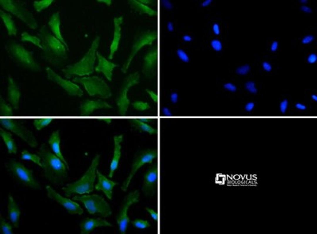 Immunocytochemistry/Immunofluorescence: Park7(DJ-1) Antibody [NB100-483] - Park7(DJ-1) antibody was tested in HeLa cells with DyLight 488 (green). Nuclei and alpha-tubulin were counterstained with DAPI (blue) and Dylight 550 (red).