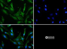 Immunocytochemistry/Immunofluorescence: Park7(DJ-1) Antibody [NB100-483] - Park7(DJ-1) antibody was tested in HeLa cells with DyLight 488 (green). Nuclei and alpha-tubulin were counterstained with DAPI (blue) and Dylight 550 (red).