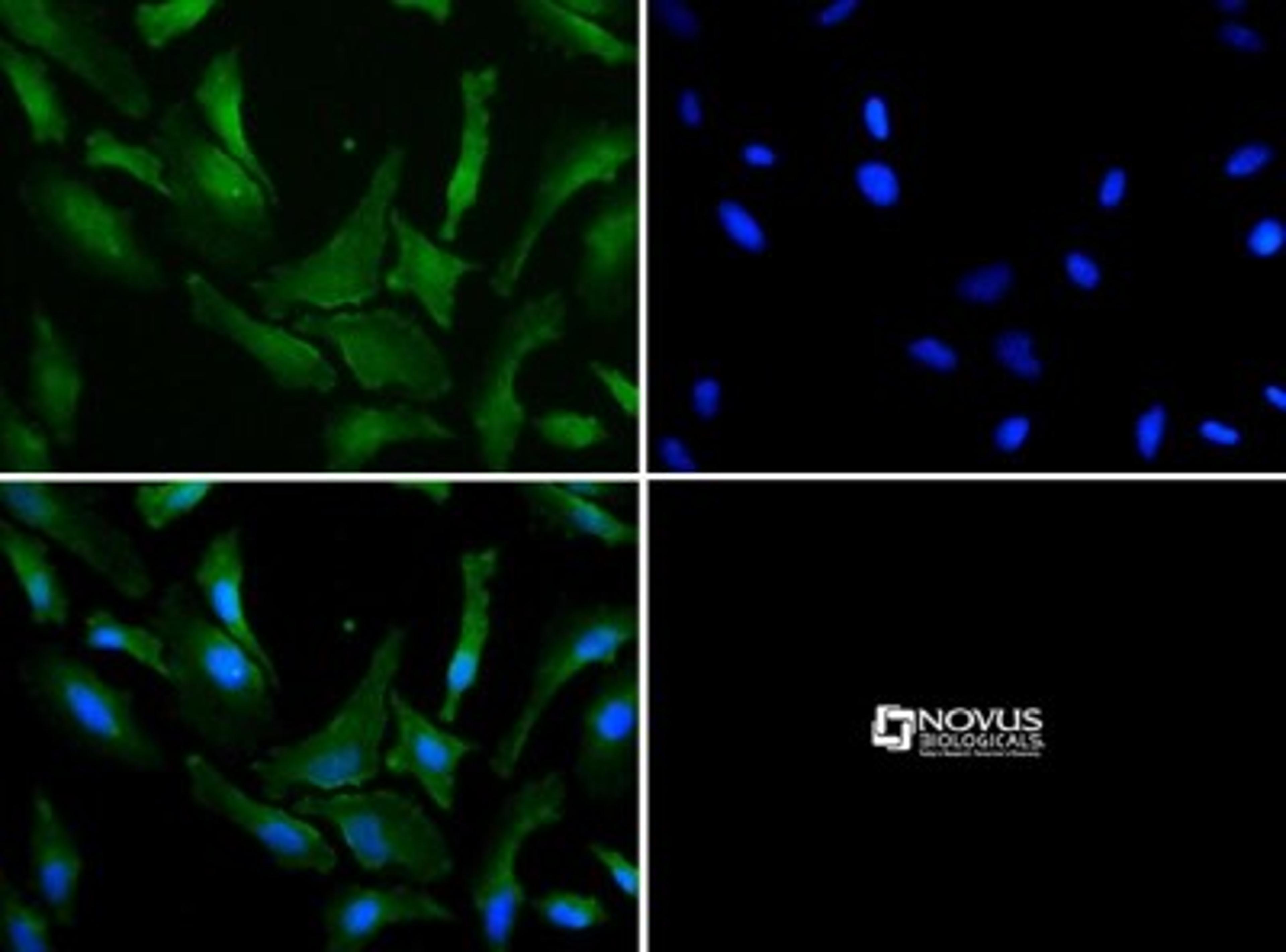 Immunocytochemistry/Immunofluorescence: Park7(DJ-1) Antibody [NB100-483] - Park7(DJ-1) antibody was tested in HeLa cells with DyLight 488 (green). Nuclei and alpha-tubulin were counterstained with DAPI (blue) and Dylight 550 (red).