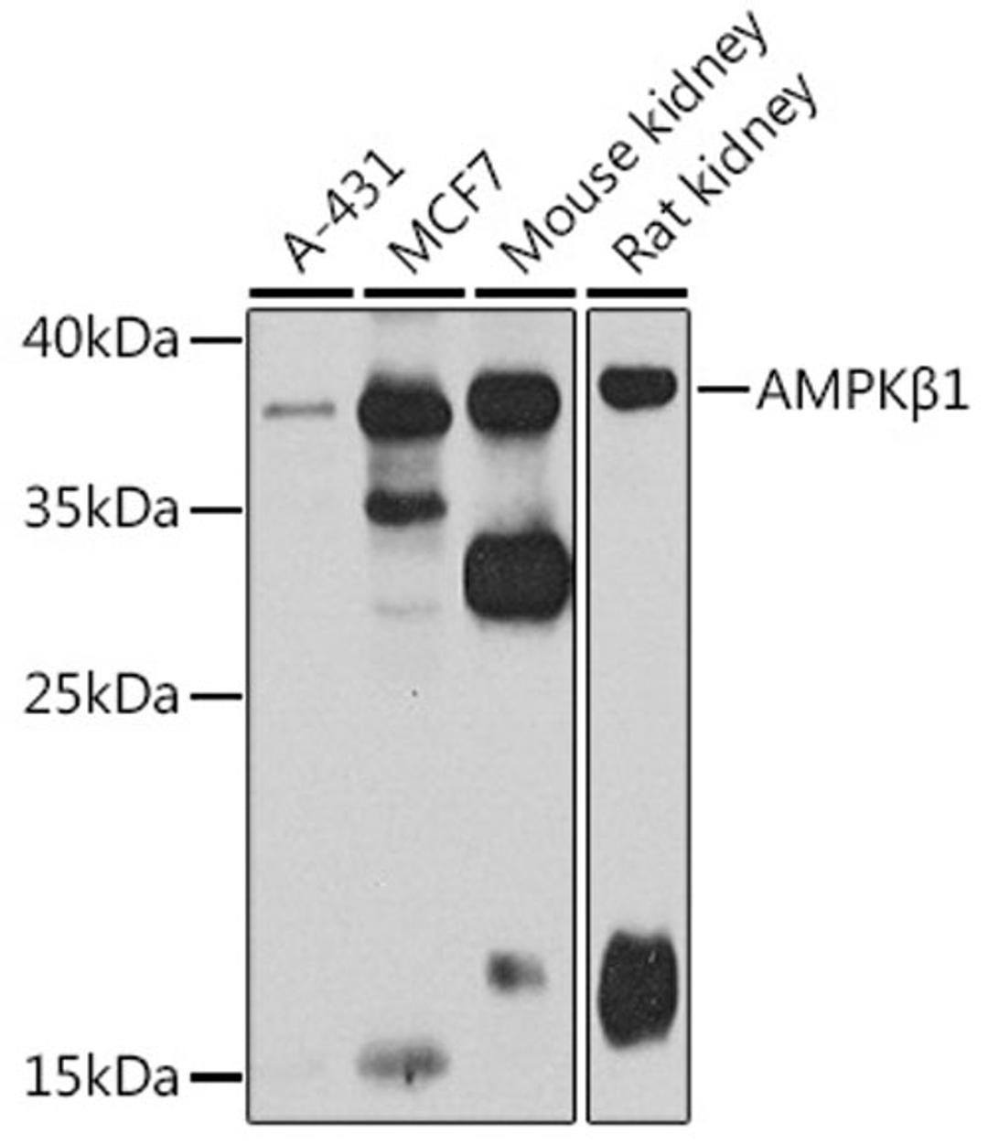 Western blot - AMPKß1 antibody (A7921)