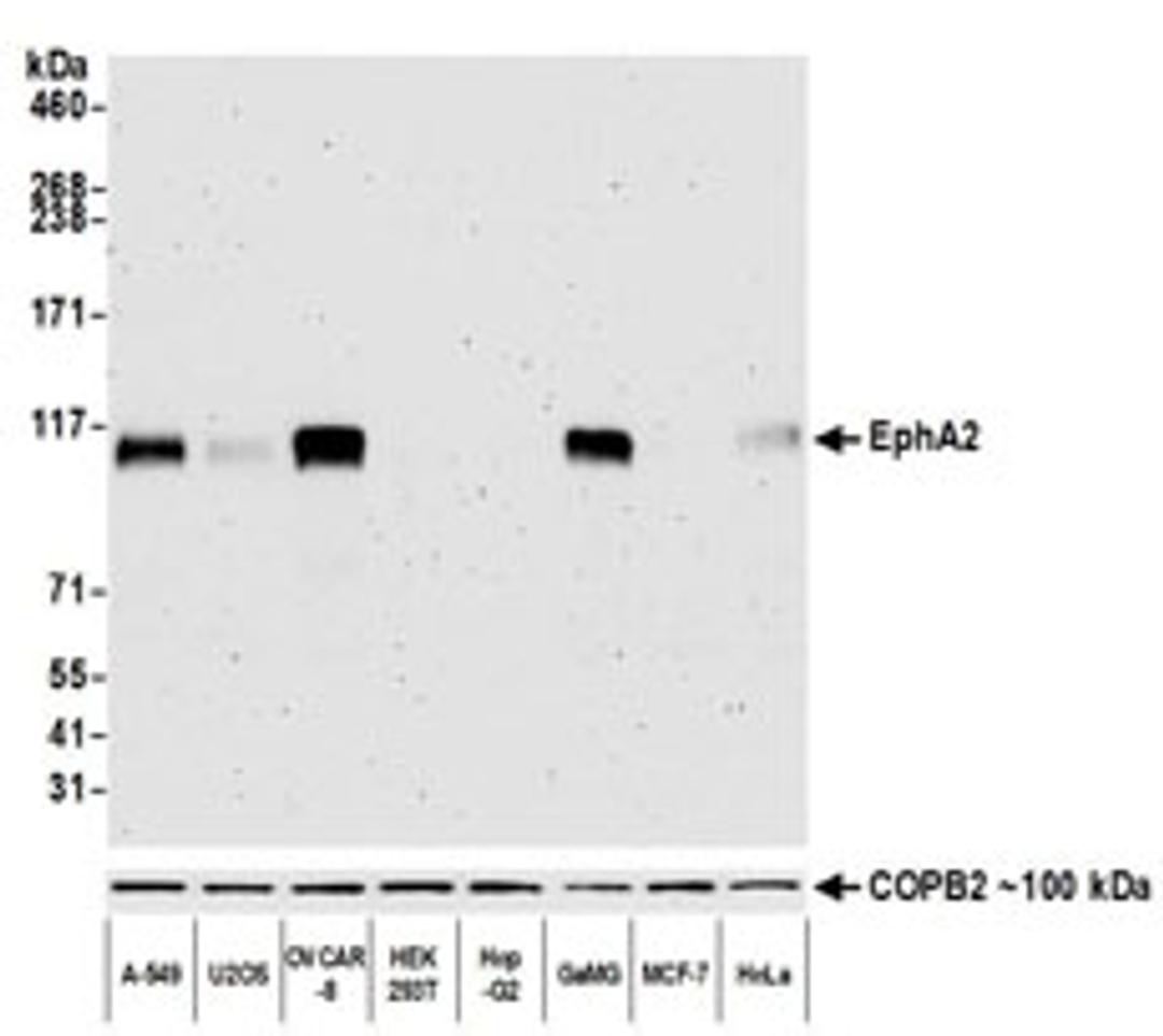 Detection of human EphA2 by western blot.