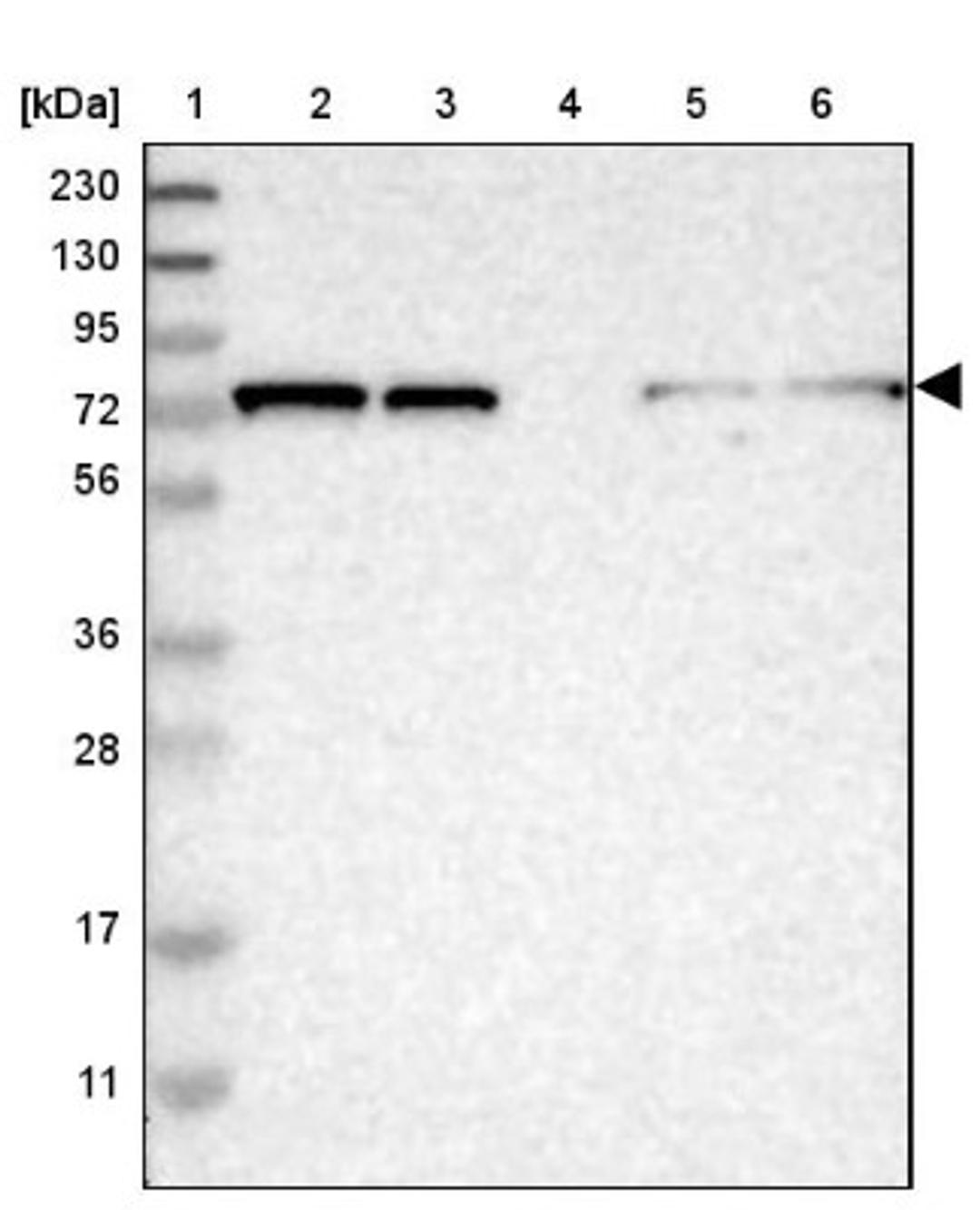 Western Blot: TBC1D15 Antibody [NBP1-90503] - Lane 1: Marker [kDa] 230, 130, 95, 72, 56, 36, 28, 17, 11<br/>Lane 2: Human cell line RT-4<br/>Lane 3: Human cell line U-251MG sp<br/>Lane 4: Human plasma (IgG/HSA depleted)<br/>Lane 5: Human liver tissue<br/>Lane 6: Human tonsil tissue