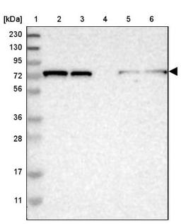 Western Blot: TBC1D15 Antibody [NBP1-90503] - Lane 1: Marker [kDa] 230, 130, 95, 72, 56, 36, 28, 17, 11<br/>Lane 2: Human cell line RT-4<br/>Lane 3: Human cell line U-251MG sp<br/>Lane 4: Human plasma (IgG/HSA depleted)<br/>Lane 5: Human liver tissue<br/>Lane 6: Human tonsil tissue