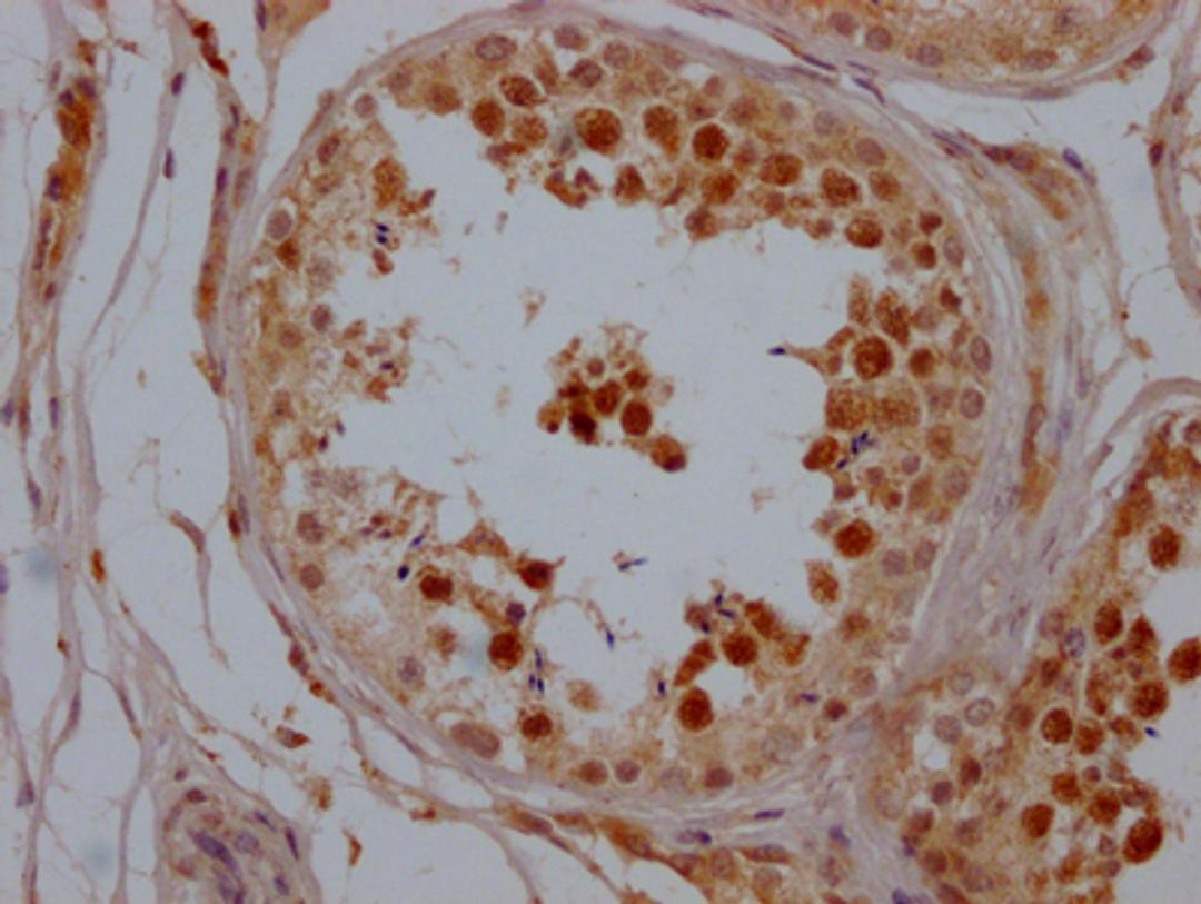 IHC image of CSB-RA556800A0HU diluted at 1:100 and staining in paraffin-embedded human testis tissue performed on a Leica BondTM system. After dewaxing and hydration, antigen retrieval was mediated by high pressure in a citrate buffer (pH 6.0). Section was blocked with 10% normal goat serum 30min at RT. Then primary antibody (1% BSA) was incubated at 4℃ overnight. The primary is detected by a Goat anti-rabbit IgG polymer labeled by HRP and visualized using 0.05% DAB.