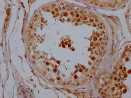 IHC image of CSB-RA556800A0HU diluted at 1:100 and staining in paraffin-embedded human testis tissue performed on a Leica BondTM system. After dewaxing and hydration, antigen retrieval was mediated by high pressure in a citrate buffer (pH 6.0). Section was blocked with 10% normal goat serum 30min at RT. Then primary antibody (1% BSA) was incubated at 4℃ overnight. The primary is detected by a Goat anti-rabbit IgG polymer labeled by HRP and visualized using 0.05% DAB.