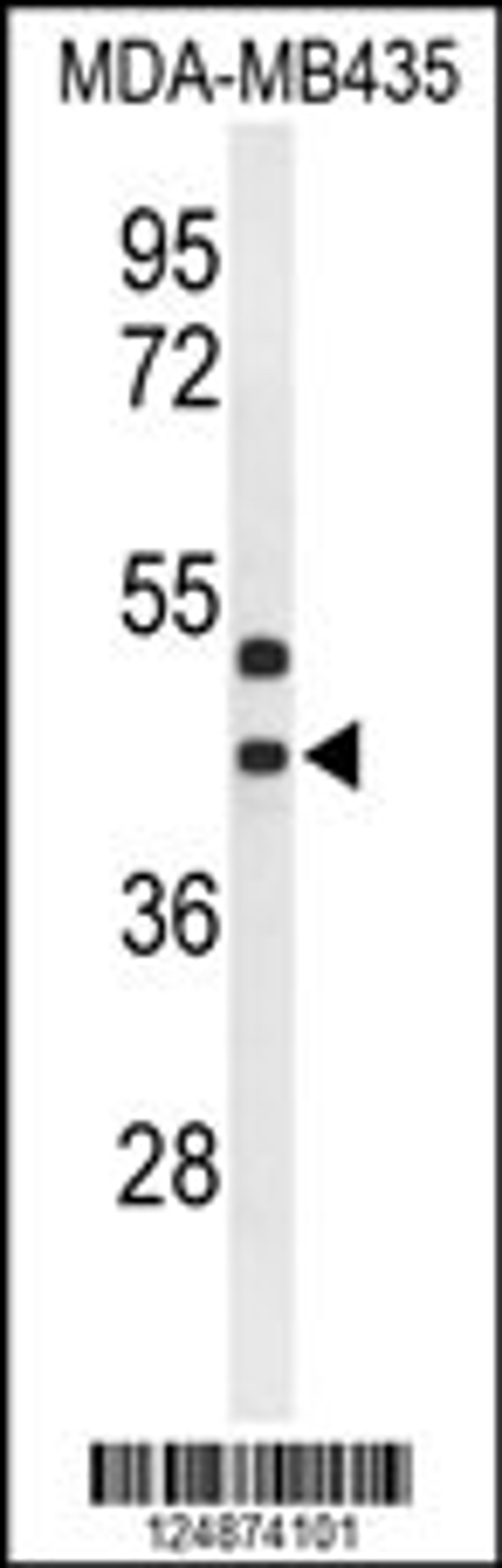 Western blot analysis of GPR17 Antibody in MDA-MB435 cell line lysates (35ug/lane)