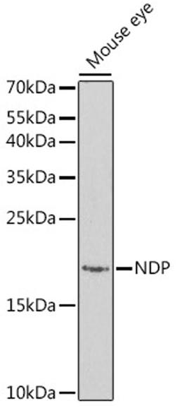 Western blot - NDP antibody (A1964)