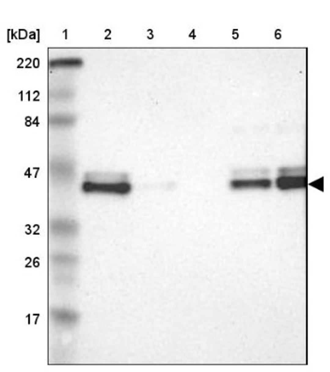 Western Blot: IKB epsilon Antibody [NBP1-87762] - Lane 1: Marker [kDa] 220, 112, 84, 47, 32, 26, 17<br/>Lane 2: Human cell line RT-4<br/>Lane 3: Human cell line U-251MG sp<br/>Lane 4: Human plasma (IgG/HSA depleted)<br/>Lane 5: Human liver tissue<br/>Lane 6: Human tonsil tissue