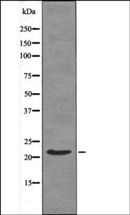 Western blot analysis of EGF treated 293 whole cell lysates using Syndecan4 -Phospho-Ser179- antibody