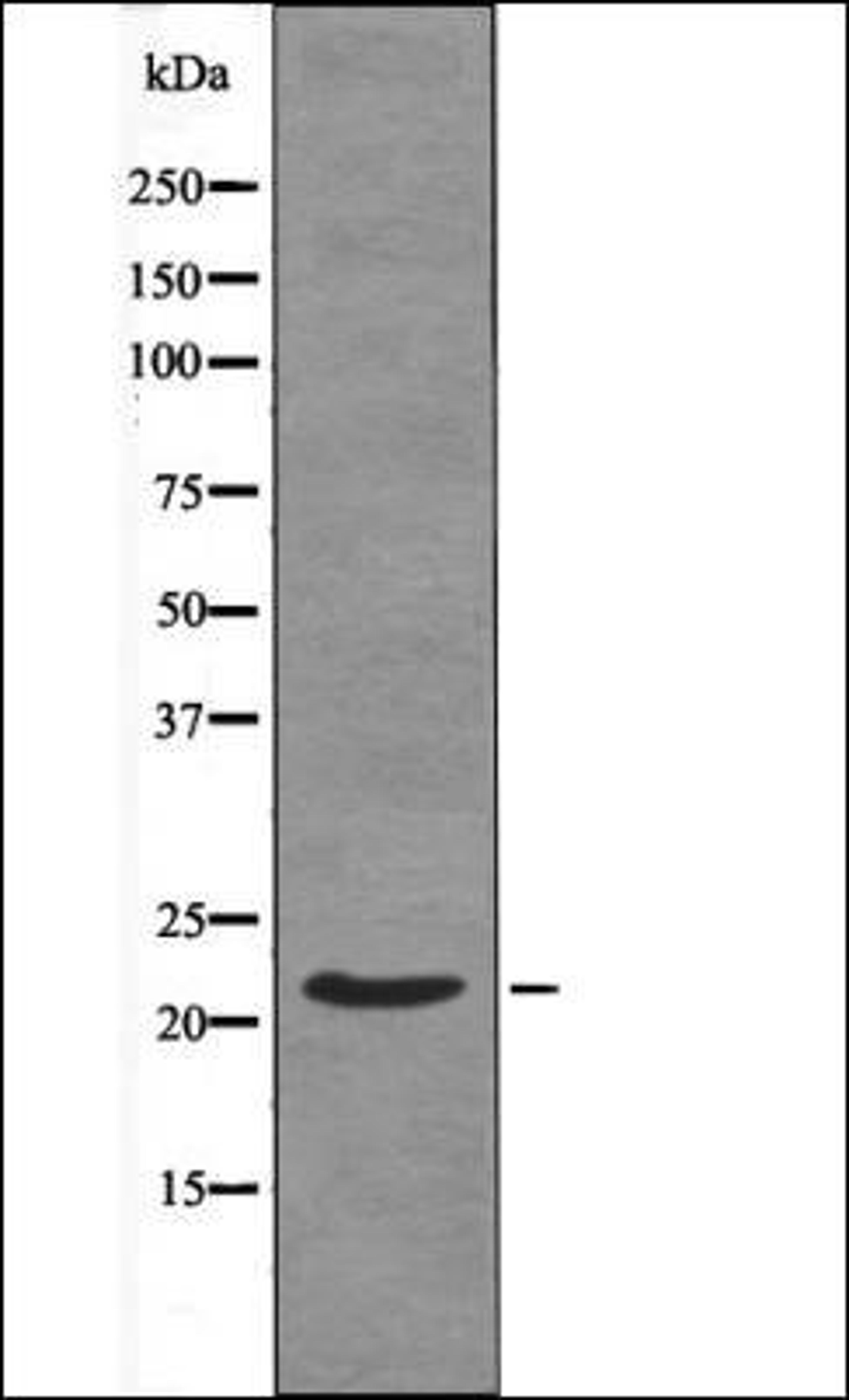 Western blot analysis of EGF treated 293 whole cell lysates using Syndecan4 -Phospho-Ser179- antibody