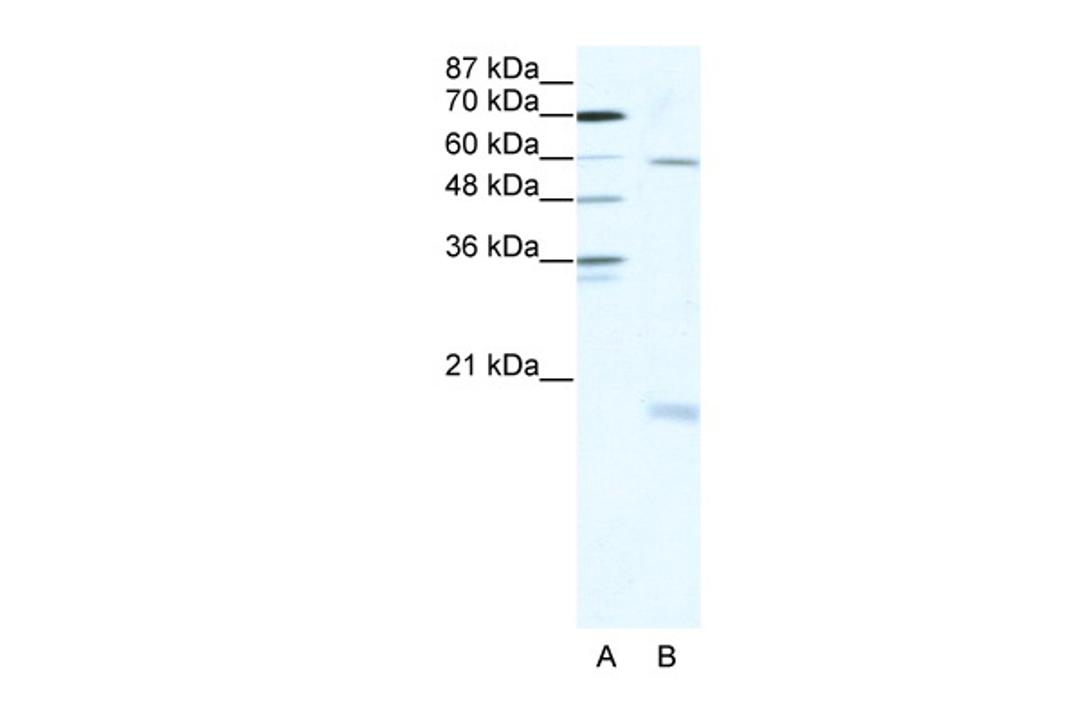 Antibody used in WB on Human HepG2 cells at 2.5 ug/ml.