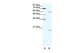 Antibody used in WB on Human HepG2 cells at 2.5 ug/ml.