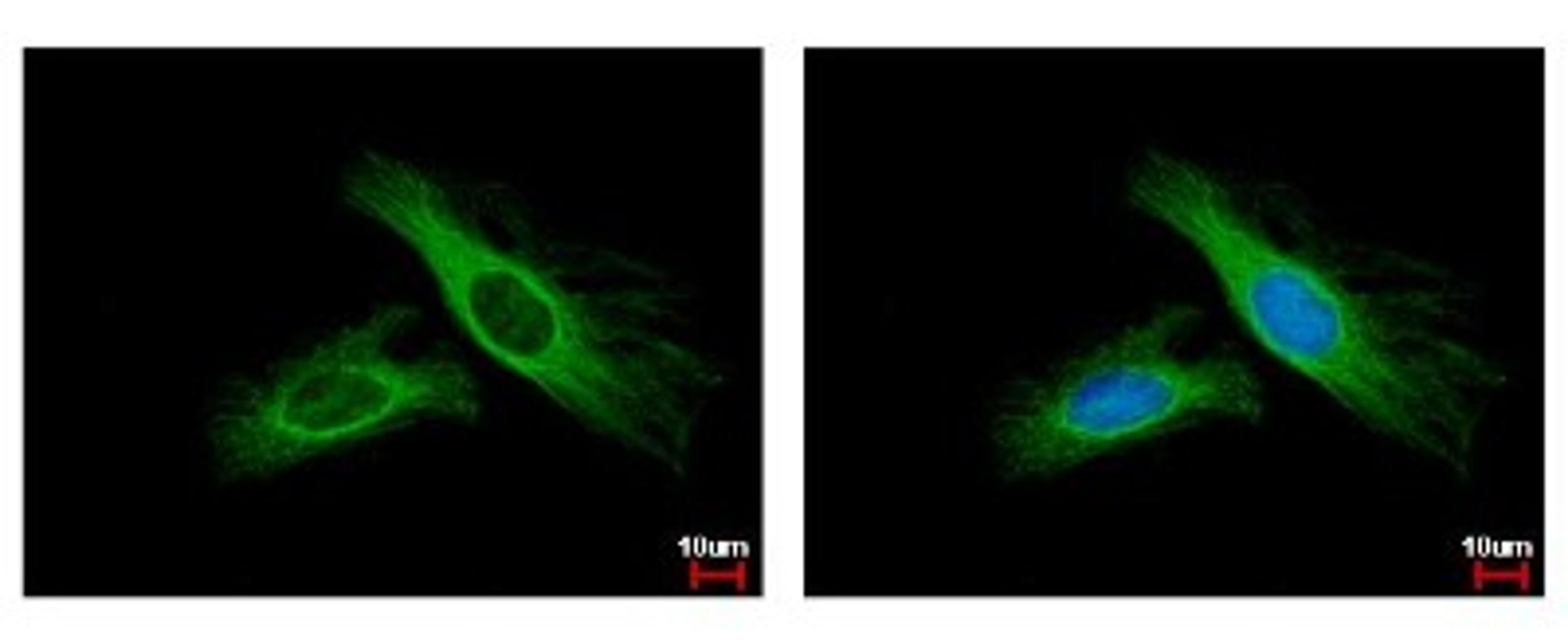 Immunocytochemistry/Immunofluorescence: FBXL6 Antibody [NBP1-31020] - Analysis of methanol-fixed A431, using antibody at 1:500 dilution.