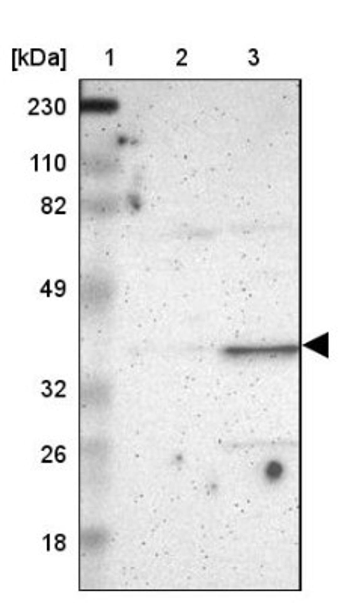 Western Blot: PLSCR4 Antibody [NBP1-86165] - Lane 1: Marker [kDa] 230, 110, 82, 49, 32, 26, 18<br/>Lane 2: Human cell line RT-4<br/>Lane 3: Human cell line U-251MG sp