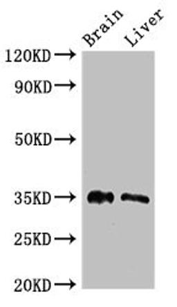 Western Blot. Positive WB detected in: Mouse brain tissue, Rat liver tissue. All lanes: PTF1A antibody at 2.7ug/ml. Secondary. Goat polyclonal to rabbit IgG at 1/50000 dilution. Predicted band size: 35 kDa. Observed band size: 35 kDa. 