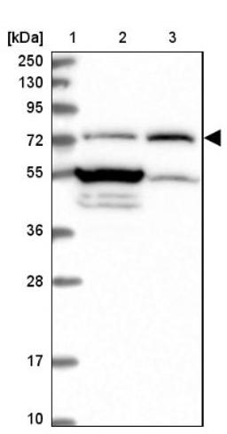 Western Blot: FAM47B Antibody [NBP2-13998] - Lane 1: Marker [kDa] 250, 130, 95, 72, 55, 36, 28, 17, 10<br/>Lane 2: Human cell line RT-4<br/>Lane 3: Human cell line U-251MG sp