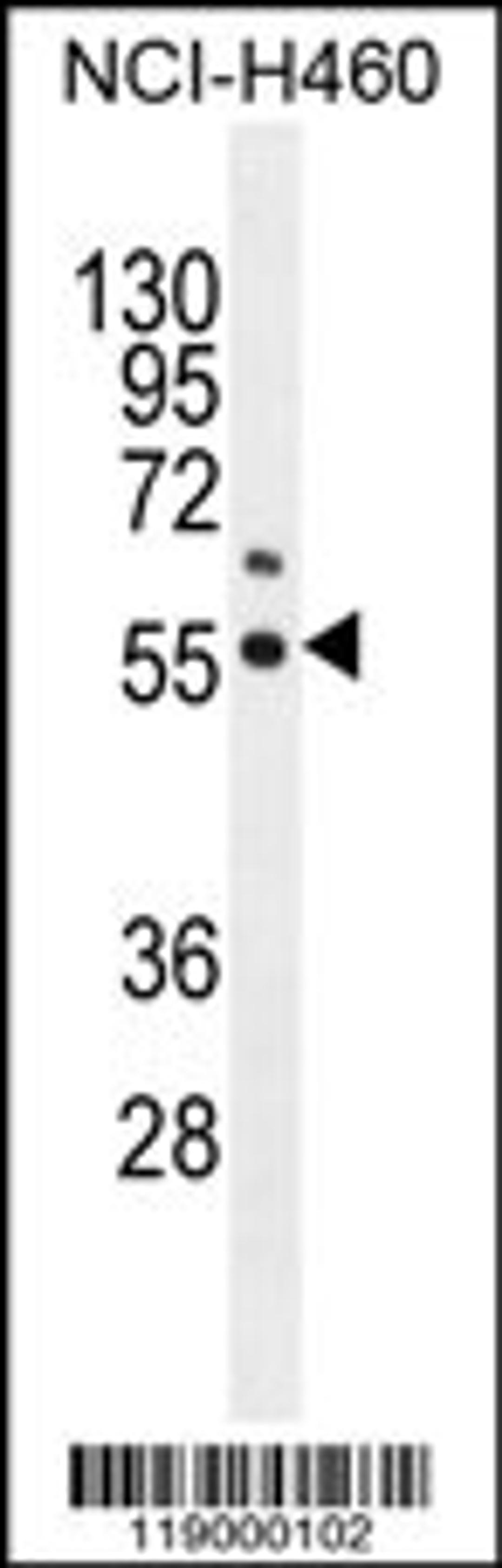 Western blot analysis in NCI-H460 cell line lysates (35ug/lane).