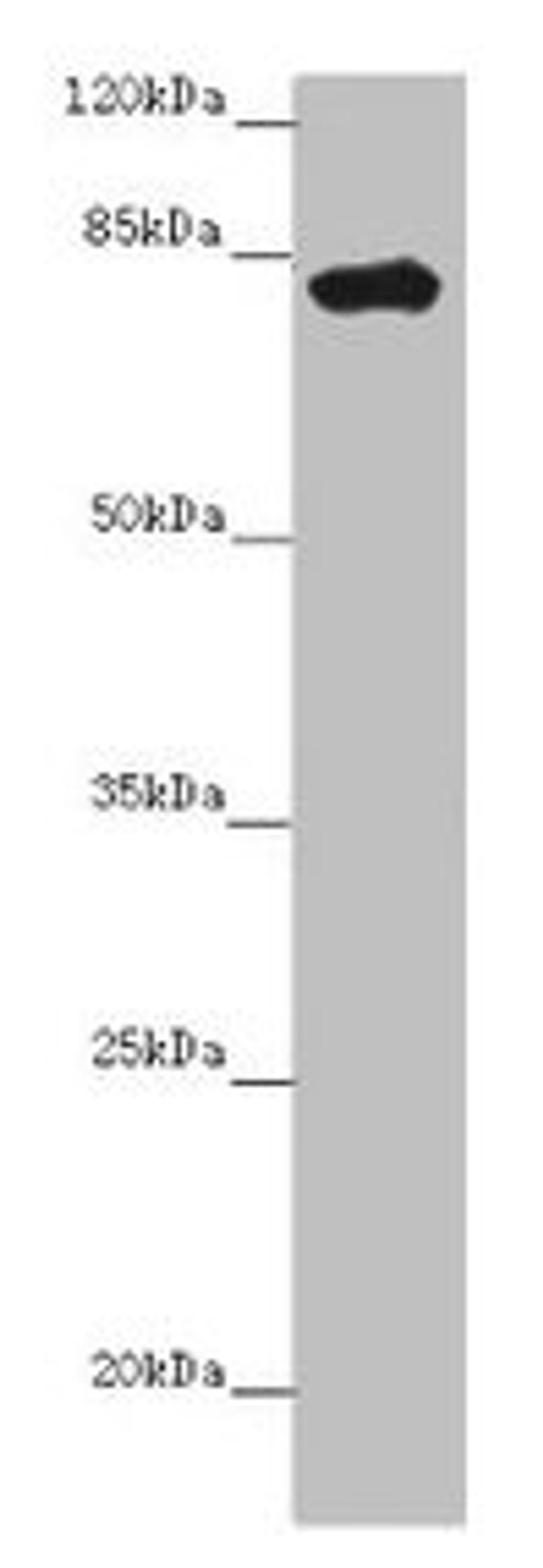 Western blot. All lanes: LRCH1 antibody at 15µg/ml + Hela whole cell lysate. Secondary. Goat polyclonal to rabbit IgG at 1/10000 dilution. Predicted band size: 81, 78, 85 kDa. Observed band size: 81 kDa